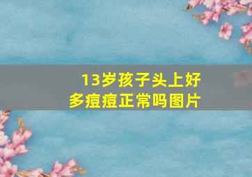 13岁孩子头上好多痘痘正常吗图片