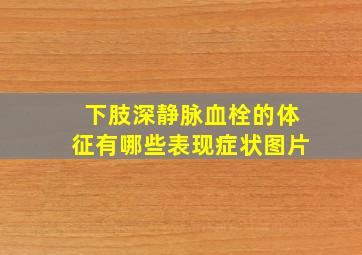 下肢深静脉血栓的体征有哪些表现症状图片