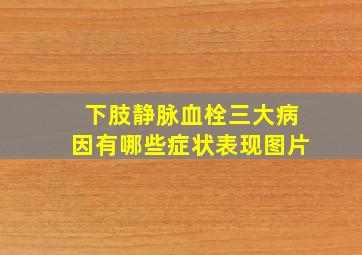 下肢静脉血栓三大病因有哪些症状表现图片