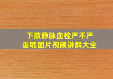 下肢静脉血栓严不严重呢图片视频讲解大全