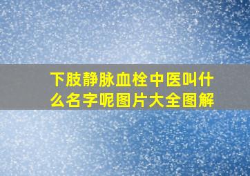 下肢静脉血栓中医叫什么名字呢图片大全图解