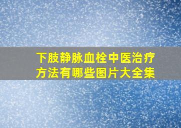 下肢静脉血栓中医治疗方法有哪些图片大全集