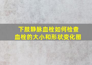 下肢静脉血栓如何检查血栓的大小和形状变化图