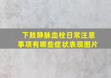 下肢静脉血栓日常注意事项有哪些症状表现图片