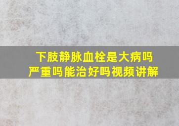 下肢静脉血栓是大病吗严重吗能治好吗视频讲解