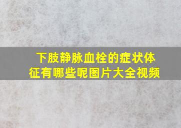 下肢静脉血栓的症状体征有哪些呢图片大全视频