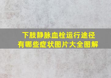 下肢静脉血栓运行途径有哪些症状图片大全图解