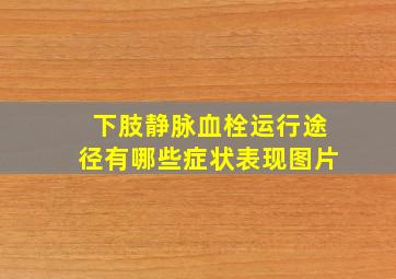 下肢静脉血栓运行途径有哪些症状表现图片