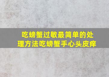 吃螃蟹过敏最简单的处理方法吃螃蟹手心头皮痒