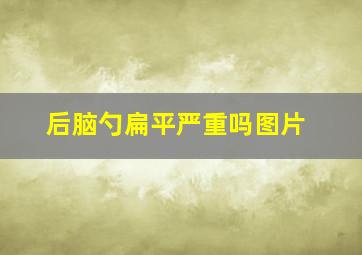 后脑勺扁平严重吗图片