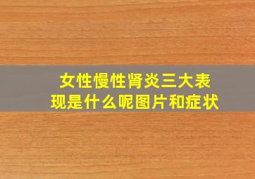 女性慢性肾炎三大表现是什么呢图片和症状