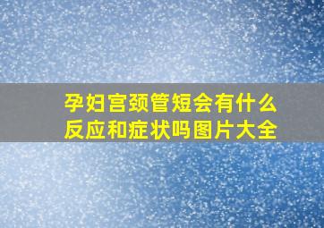 孕妇宫颈管短会有什么反应和症状吗图片大全