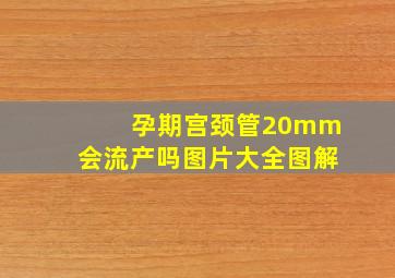 孕期宫颈管20mm会流产吗图片大全图解