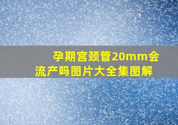 孕期宫颈管20mm会流产吗图片大全集图解