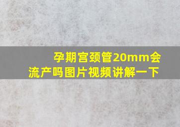 孕期宫颈管20mm会流产吗图片视频讲解一下