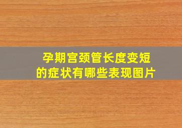 孕期宫颈管长度变短的症状有哪些表现图片