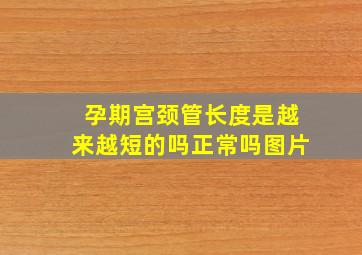 孕期宫颈管长度是越来越短的吗正常吗图片