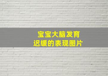 宝宝大脑发育迟缓的表现图片