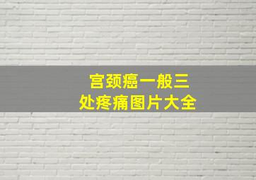 宫颈癌一般三处疼痛图片大全