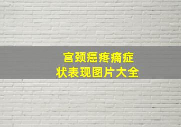 宫颈癌疼痛症状表现图片大全