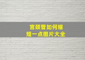 宫颈管如何缩短一点图片大全