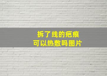 拆了线的疤痕可以热敷吗图片