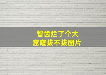 智齿烂了个大窟窿拔不拔图片