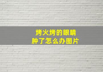 烤火烤的眼睛肿了怎么办图片