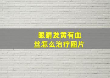 眼睛发黄有血丝怎么治疗图片