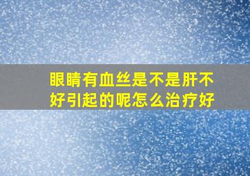 眼睛有血丝是不是肝不好引起的呢怎么治疗好