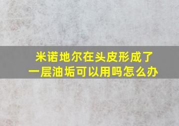 米诺地尔在头皮形成了一层油垢可以用吗怎么办