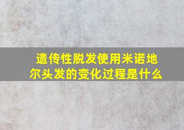 遗传性脱发使用米诺地尔头发的变化过程是什么