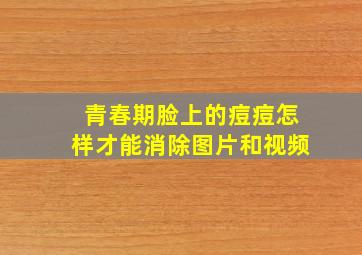 青春期脸上的痘痘怎样才能消除图片和视频