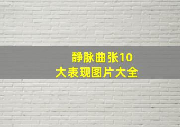 静脉曲张10大表现图片大全