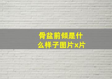 骨盆前倾是什么样子图片x片