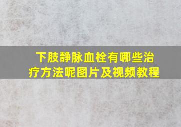 下肢静脉血栓有哪些治疗方法呢图片及视频教程