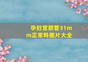 孕妇宫颈管31mm正常吗图片大全