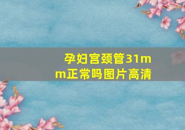 孕妇宫颈管31mm正常吗图片高清