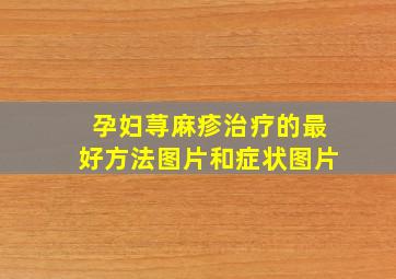 孕妇荨麻疹治疗的最好方法图片和症状图片