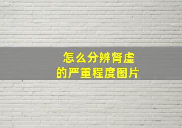 怎么分辨肾虚的严重程度图片