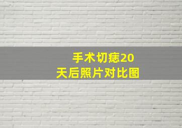 手术切痣20天后照片对比图