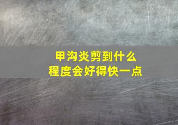 甲沟炎剪到什么程度会好得快一点