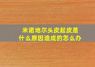 米诺地尔头皮起皮是什么原因造成的怎么办