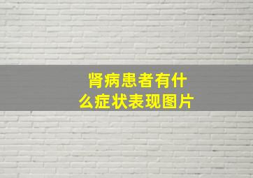 肾病患者有什么症状表现图片