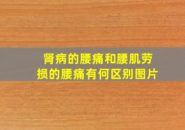 肾病的腰痛和腰肌劳损的腰痛有何区别图片