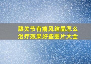 膝关节有痛风结晶怎么治疗效果好些图片大全