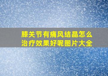 膝关节有痛风结晶怎么治疗效果好呢图片大全